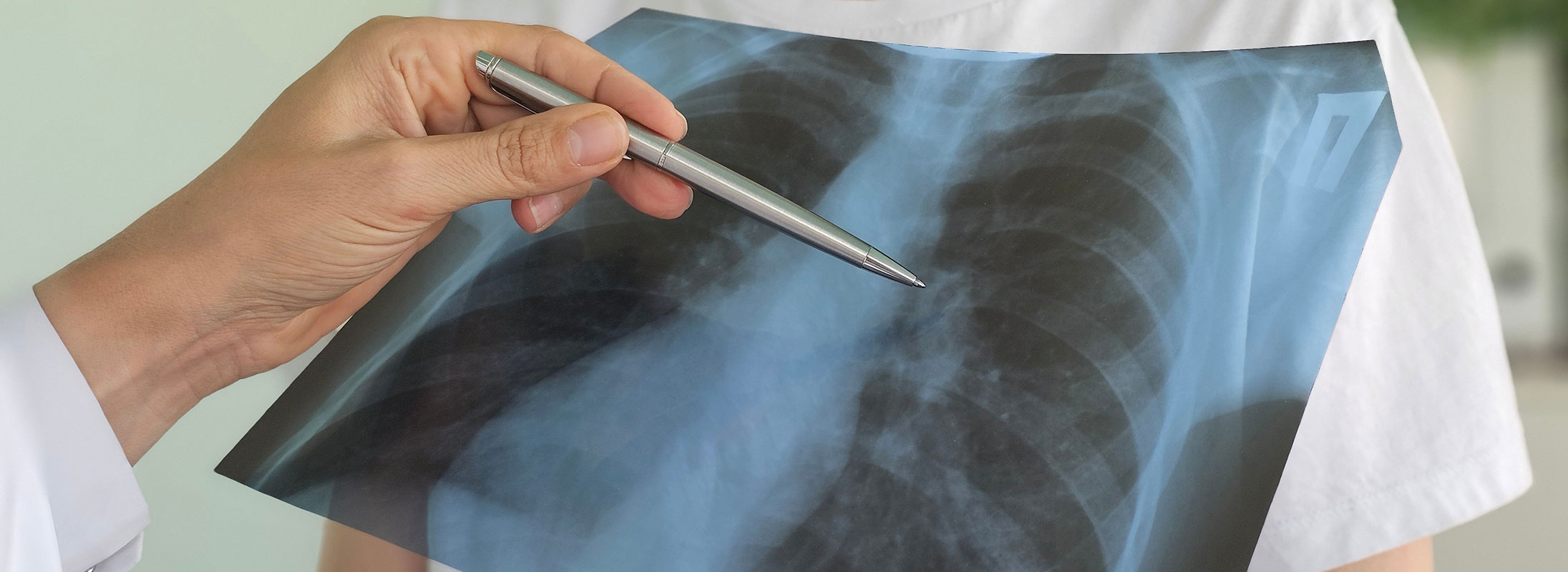 Arzt erklärt einem Patienten eine Thorax-Röntgenaufnahme von Herz und Lunge.